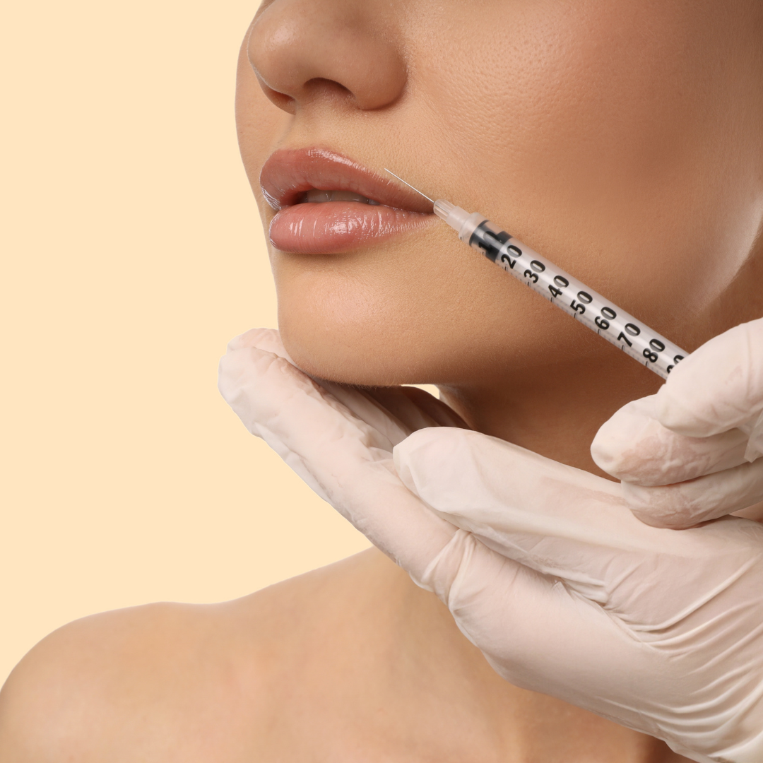 Preenchimento labial com planejamento natural