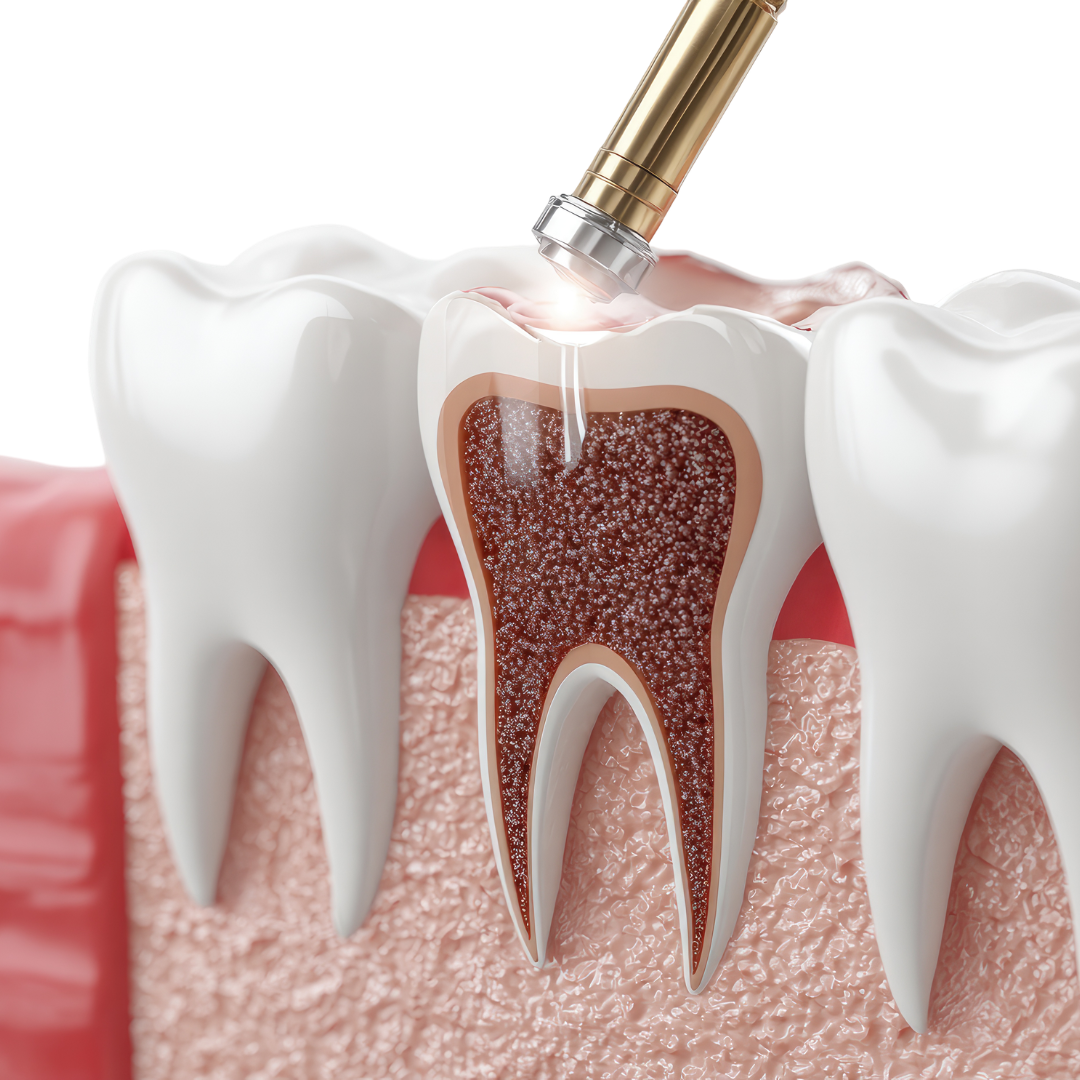 Tratamento de canal com especialista em endodontia
